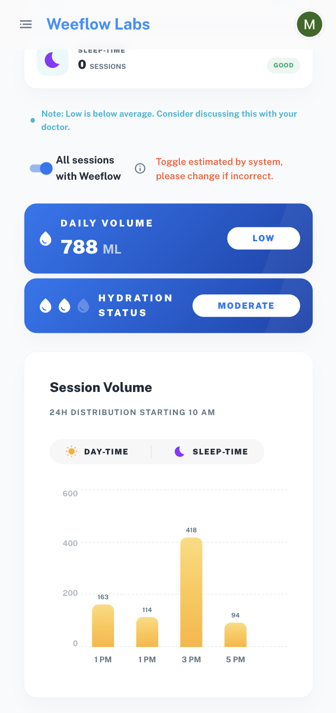 Per-session voided volume across the day.